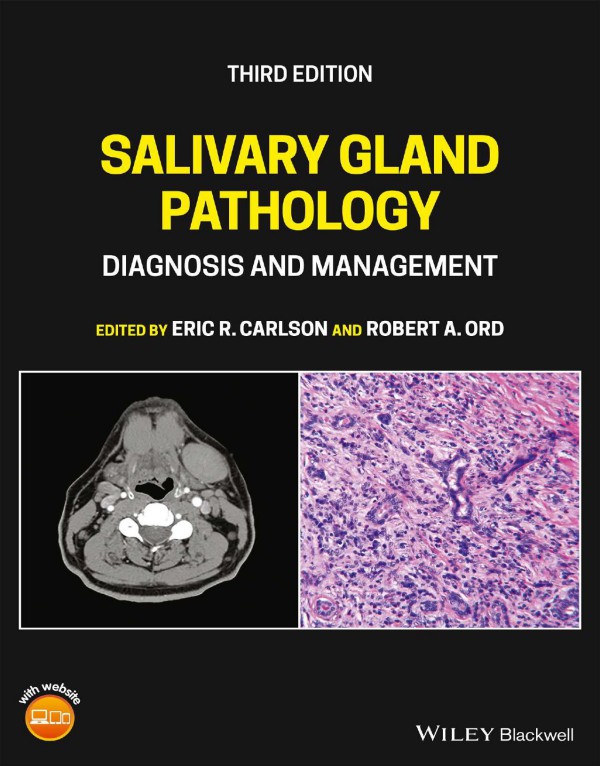 Cover of Salivary Gland Pathology: Diagnosis and Management