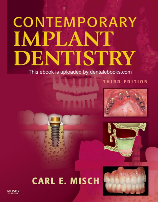 Cover of Contemporary Implant Dentistry